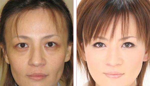 RV極速美塑美膚價格要多少？