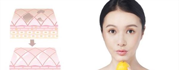 做果酸美白費用大概需要多少