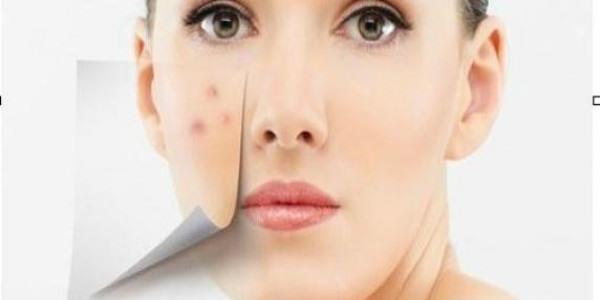 <a href=http://www.f3bb6.cn/listinfo-767-0.html target=_blank class=infotextkey>祛痣</a>會腫嗎