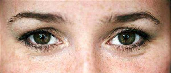 e光<a href=http://www.f3bb6.cn/listinfo-795-0.html target=_blank class=infotextkey>祛斑</a>是如何祛除老年斑的