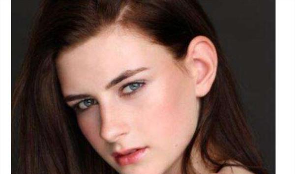 E光<a href=http://www.f3bb6.cn/listinfo-795-0.html target=_blank class=infotextkey>祛斑</a>后注意事項(xiàng)