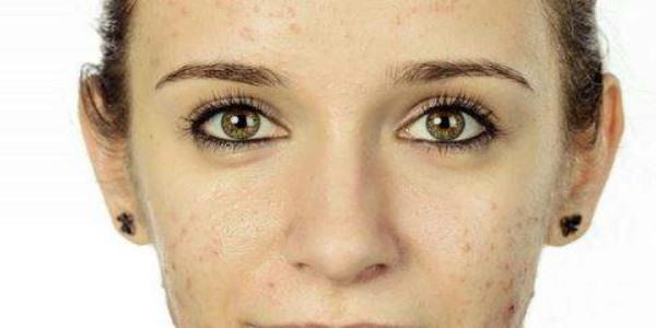 激光<a href=http://www.f3bb6.cn/listinfo-795-0.html target=_blank class=infotextkey>祛斑</a>多長時間恢復(fù)