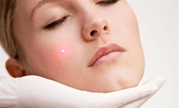 皮膚長斑的原因及去除的方式
