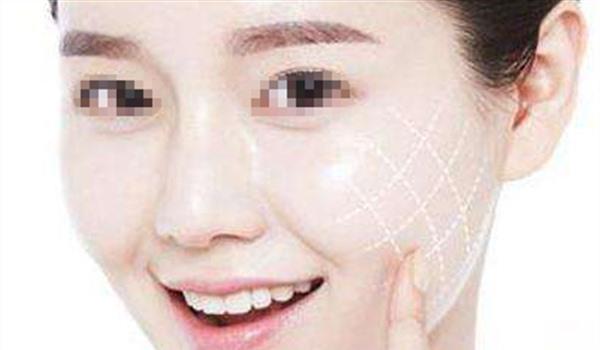 上海哪家醫院做埋線提升好？