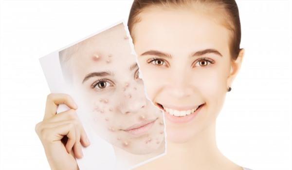 激光<a href=http://www.f3bb6.cn/listinfo-797-0.html target=_blank class=infotextkey>去痘疤</a>價格