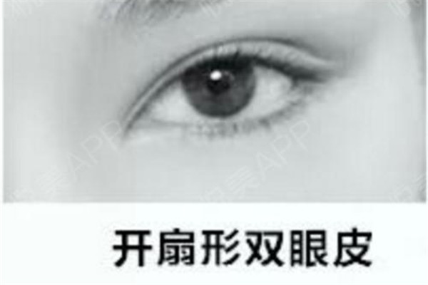 做<a href=http://www.f3bb6.cn/listinfo-724-0.html target=_blank class=infotextkey>雙眼皮</a>可以不開刀嗎 不開刀可以做<a href=http://www.f3bb6.cn/listinfo-724-0.html target=_blank class=infotextkey>雙眼皮</a>嗎