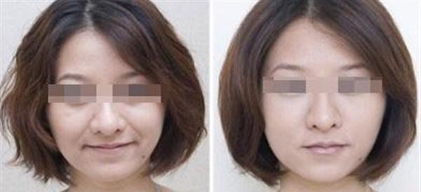 做<a href=http://www.f3bb6.cn/listinfo-734-0.html target=_blank class=infotextkey>愛貝芙</a><a href=http://www.f3bb6.cn/listinfo-792-0.html target=_blank class=infotextkey>去法令紋</a>費(fèi)用大概需要多少