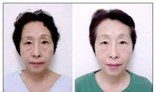 做鉆石微雕價格