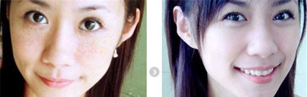 做<a href=http://www.f3bb6.cn/listinfo-795-0.html target=_blank class=infotextkey>祛斑</a>價格