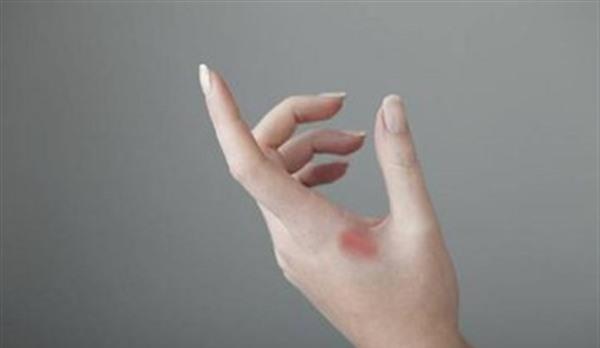 <a href=http://www.f3bb6.cn/listinfo-783-0.html target=_blank class=infotextkey>祛疤</a>痛不痛