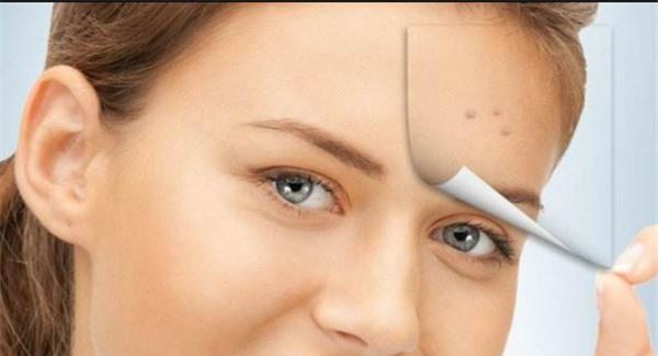 祛痘坑最有效的方法