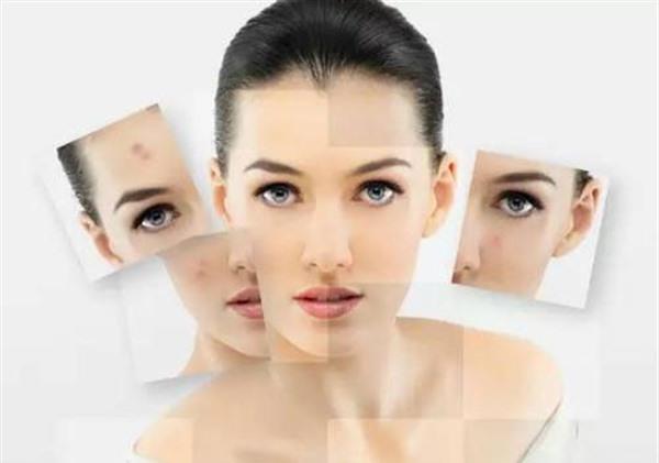 黑色痘印怎么祛除