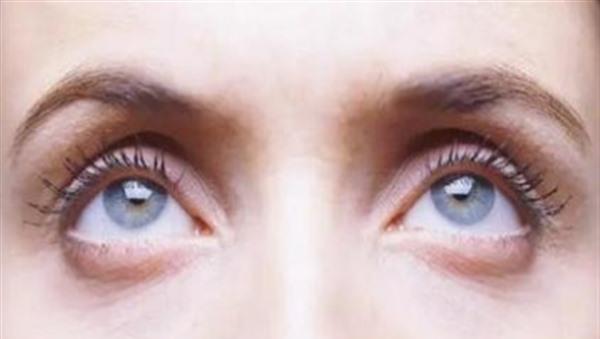 <a href=http://www.f3bb6.cn/listinfo-731-0.html target=_blank class=infotextkey>玻尿酸</a><a href=http://www.f3bb6.cn/listinfo-780-0.html target=_blank class=infotextkey>去魚尾紋</a>有副作用嗎