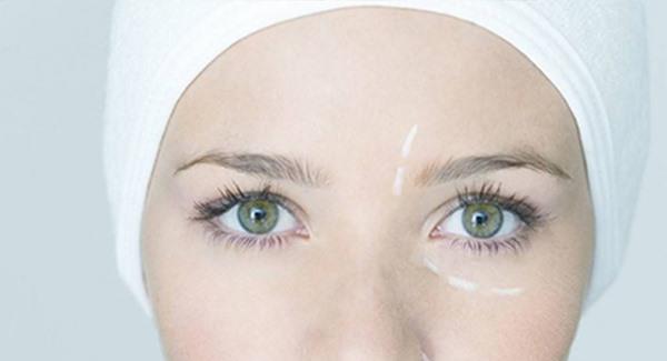 紅血絲消除的辦法