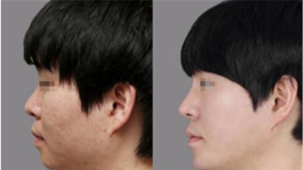 做<a href=http://www.f3bb6.cn/listinfo-734-0.html target=_blank class=infotextkey>愛貝芙</a><a href=http://www.f3bb6.cn/listinfo-797-0.html target=_blank class=infotextkey>去痘疤</a>不適應人群有哪些