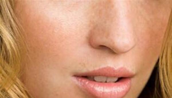 怎樣有效防止雀斑復發？