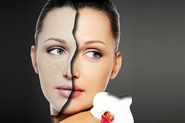 做完激光<a href=http://www.f3bb6.cn/listinfo-795-0.html target=_blank class=infotextkey>祛斑</a>飲食禁忌/激光<a href=http://www.f3bb6.cn/listinfo-774-0.html target=_blank class=infotextkey>去雀斑</a>需忌口嗎