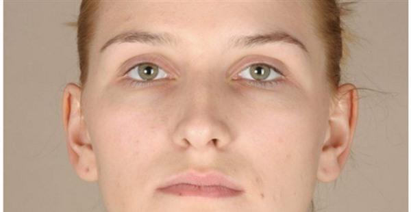 <a href=http://www.f3bb6.cn/listinfo-795-0.html target=_blank class=infotextkey>祛斑</a>手術大約多少錢