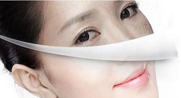 做E光<a href=http://www.f3bb6.cn/listinfo-786-0.html target=_blank class=infotextkey>去黃褐斑</a>副作用