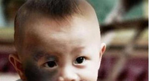 做激光<a href=http://www.f3bb6.cn/listinfo-799-0.html target=_blank class=infotextkey>去太田痣</a>要花多長時間