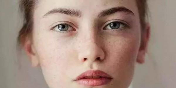 激光<a href=http://www.f3bb6.cn/listinfo-786-0.html target=_blank class=infotextkey>去黃褐斑</a>哪好