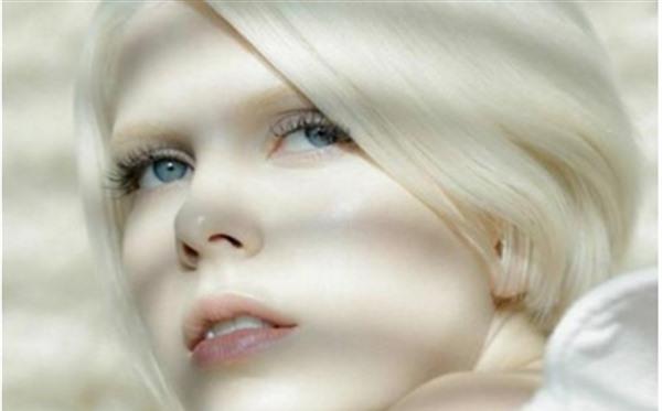 激光<a href=http://www.f3bb6.cn/listinfo-795-0.html target=_blank class=infotextkey>祛斑</a>對眼睛有傷害嗎