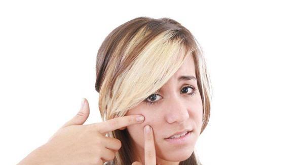 治青春痘價格是多少