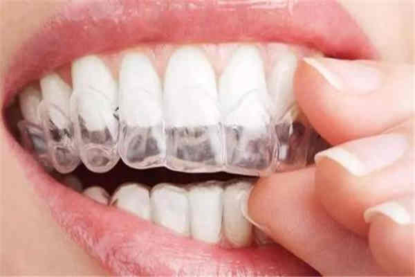 <a href=http://www.f3bb6.cn/listinfo-824-0.html target=_blank class=infotextkey>牙齒矯正</a>有年齡限制嗎 <a href=http://www.f3bb6.cn/listinfo-824-0.html target=_blank class=infotextkey>牙齒矯正</a>什么弄比較好