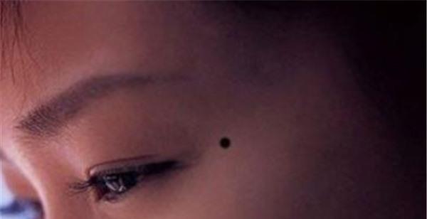 做切除手術<a href=http://www.f3bb6.cn/listinfo-788-0.html target=_blank class=infotextkey>去黑痣</a>不適應人群有哪些