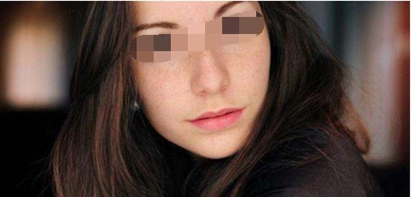 妊娠斑能自行消退嗎