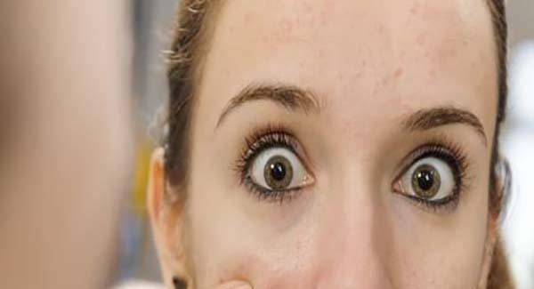 激光祛痘的注意事項