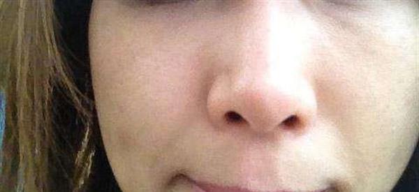 做彩光<a href=http://www.f3bb6.cn/listinfo-795-0.html target=_blank class=infotextkey>祛斑</a>風(fēng)險(xiǎn)有哪些