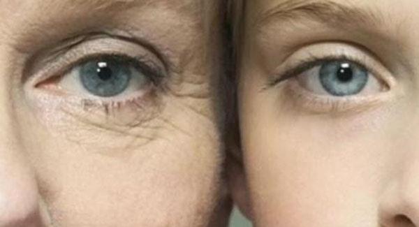 做<a href=http://www.f3bb6.cn/listinfo-780-0.html target=_blank class=infotextkey>去魚尾紋</a>副作用