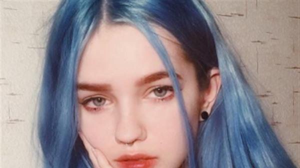 <a href=http://www.f3bb6.cn/listinfo-690-0.html target=_blank class=infotextkey>自體脂肪填充</a>法令紋的利弊有哪些