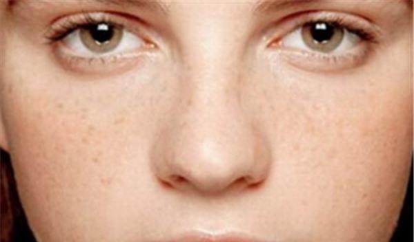 做激光<a href=http://www.f3bb6.cn/listinfo-786-0.html target=_blank class=infotextkey>去黃褐斑</a>不適應人群有哪些