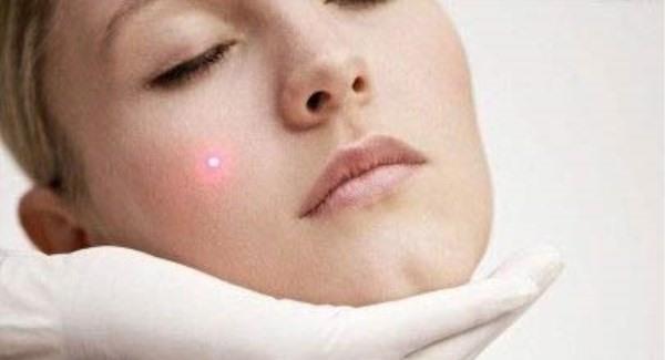 做<a href=http://www.f3bb6.cn/listinfo-770-0.html target=_blank class=infotextkey>嫩膚</a>手術注意事項是什么?