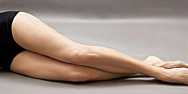 凹陷疤痕手術(shù)多少錢