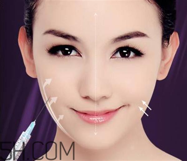 嬰兒肥能打<a href=http://www.f3bb6.cn/listinfo-631-0.html target=_blank class=infotextkey>瘦臉</a><a href=http://www.f3bb6.cn/listinfo-614-0.html target=_blank class=infotextkey>除皺</a>嗎？<a href=http://www.f3bb6.cn/listinfo-631-0.html target=_blank class=infotextkey>瘦臉</a><a href=http://www.f3bb6.cn/listinfo-614-0.html target=_blank class=infotextkey>除皺</a>打幾次可以定型？