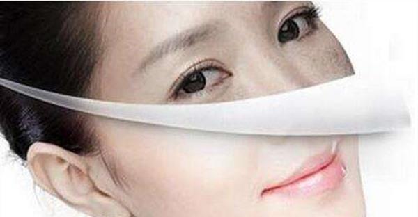 做E光<a href=http://www.f3bb6.cn/listinfo-786-0.html target=_blank class=infotextkey>去黃褐斑</a>風(fēng)險(xiǎn)有哪些