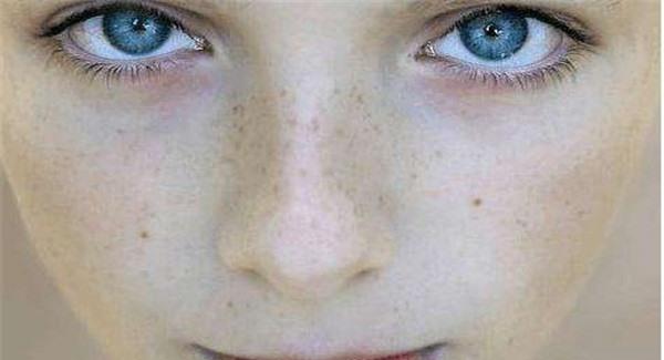 真皮斑能去掉嗎