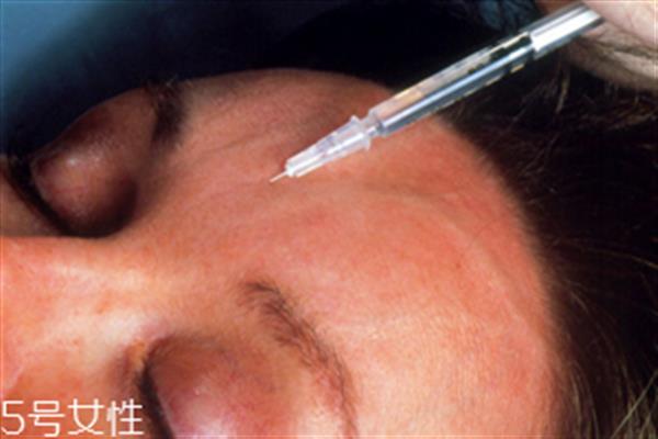 水光<a href=http://www.f3bb6.cn/listinfo-770-0.html target=_blank class=infotextkey>嫩膚</a>和美白養護哪個好 水光<a href=http://www.f3bb6.cn/listinfo-770-0.html target=_blank class=infotextkey>嫩膚</a>和美白養護能一起打嗎