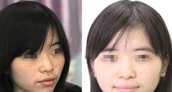 做彩光<a href=http://www.f3bb6.cn/listinfo-795-0.html target=_blank class=infotextkey>祛斑</a>副作用是什么