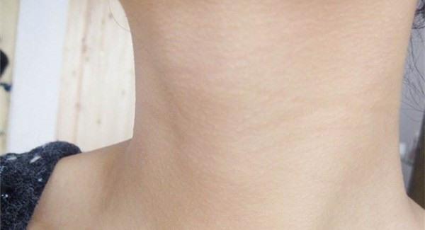 做<a href=http://www.f3bb6.cn/listinfo-785-0.html target=_blank class=infotextkey>去頸紋</a>手術注意事項是什么?