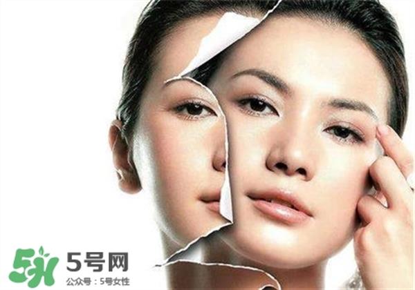 美白養護是什么?美白養護可以連續打嗎?