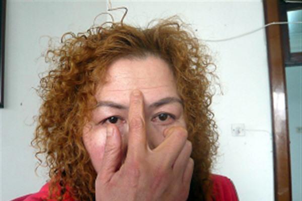 做<a href=http://www.f3bb6.cn/listinfo-765-0.html target=_blank class=infotextkey>去抬頭紋</a>失敗修復效果好不好