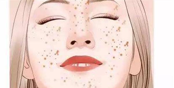 E光<a href=http://www.f3bb6.cn/listinfo-786-0.html target=_blank class=infotextkey>去黃褐斑</a>不適用人群有哪些?