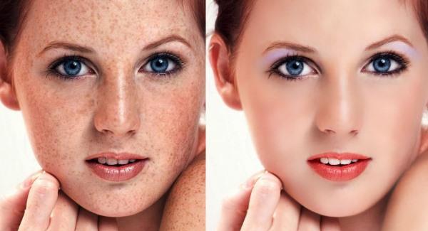 做激光<a href=http://www.f3bb6.cn/listinfo-774-0.html target=_blank class=infotextkey>去雀斑</a>需要多少錢？費(fèi)用是多少？