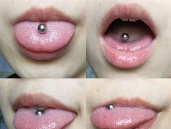 舌釘發炎了怎么辦 舌釘怎么護理