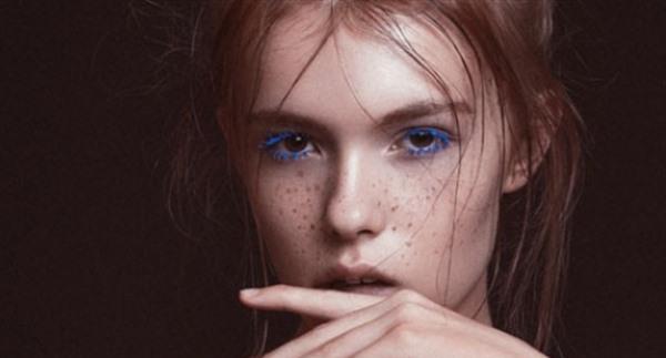 光子祛痘缺點(diǎn)