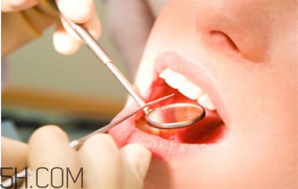 洗牙出血是正常嗎？洗牙后多久可以吃東西？